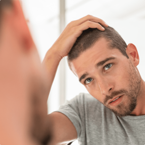 hair-loss-Treatment